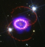 HST/Chandra images of SN 1987a